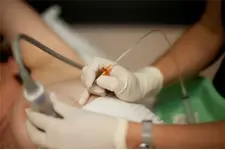 İğne Biyopsisi Nedir ve Nasıl Yapılır?