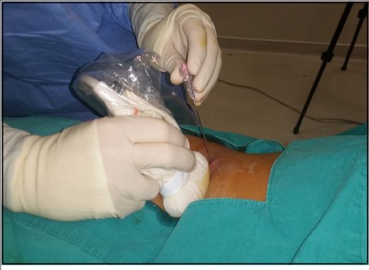 Böbrek Biyopsisi Nasıl Yapılır?