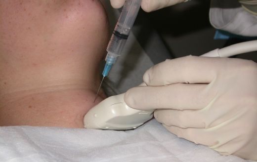 Guatr Biyopsi Nasıl Yapılır?