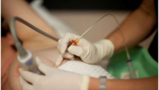 Mide Biyopsi Nasıl Yapılır?