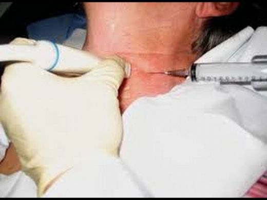 Tiroid Biyopsi Nedir ve Nasıl Yapılır?